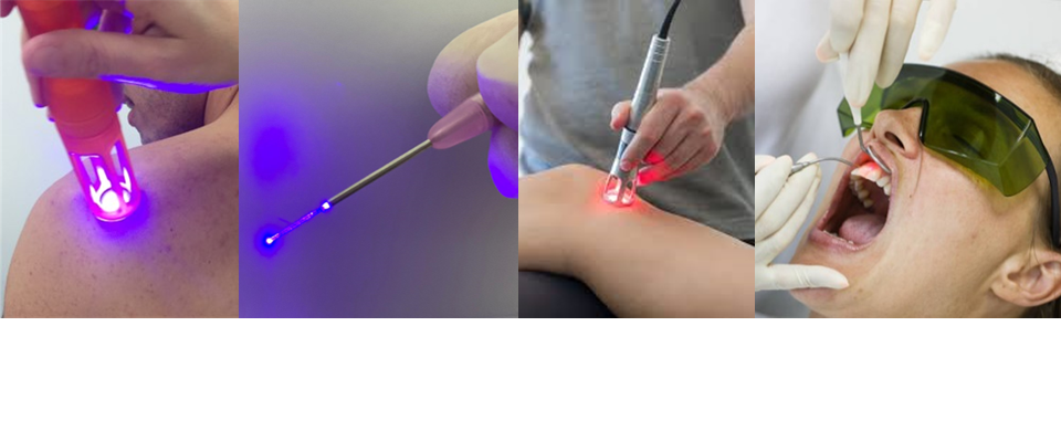 Lyocon LDM - Fiber-coupled laser - Lyocon